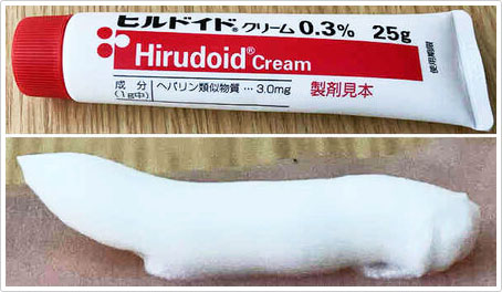 ヒルドイド（ヘパリン類似物質）クリーム